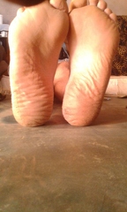 Huge Feet